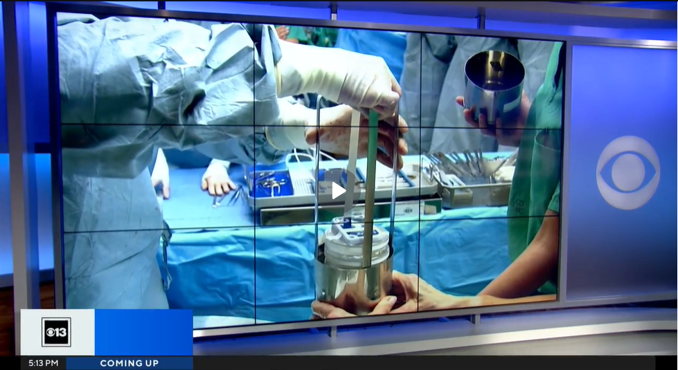 A screenshot from a video shows an operating room where someone is pulling the cell patch out of a round metal cannister.
